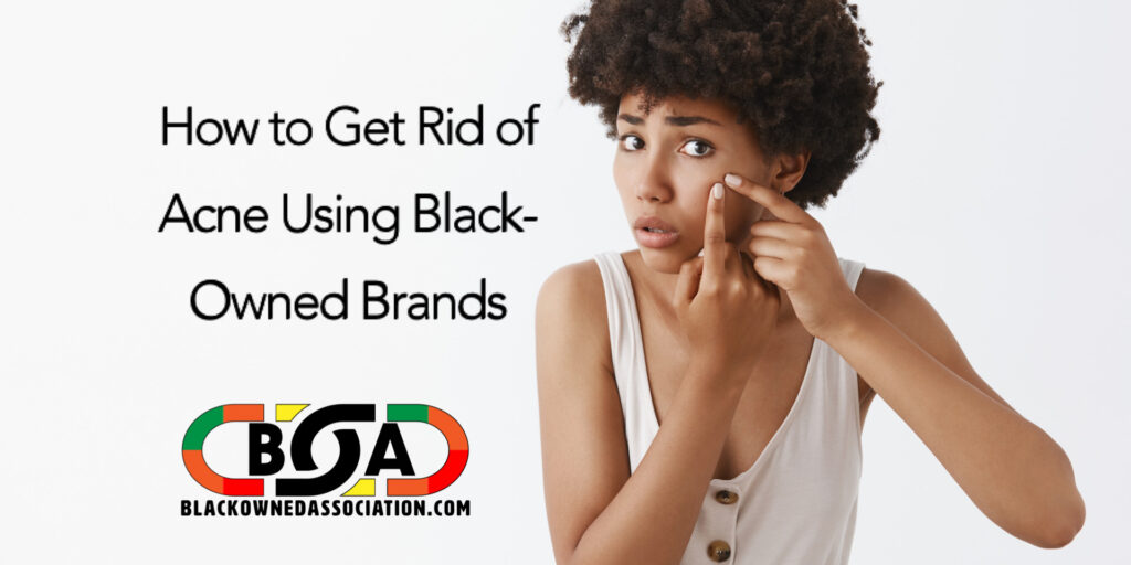 How to Get Rid of Acne Using Black-Owned Brands