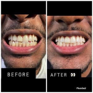 Black-owned dental care business Smile Bright by Kayla Right