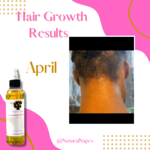 Natural Napes Hair & Skin Care black-owned business